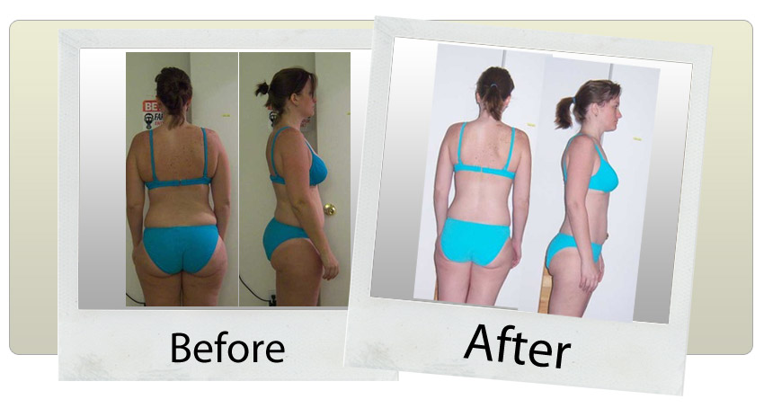 hcg diet photo hcg diet photo